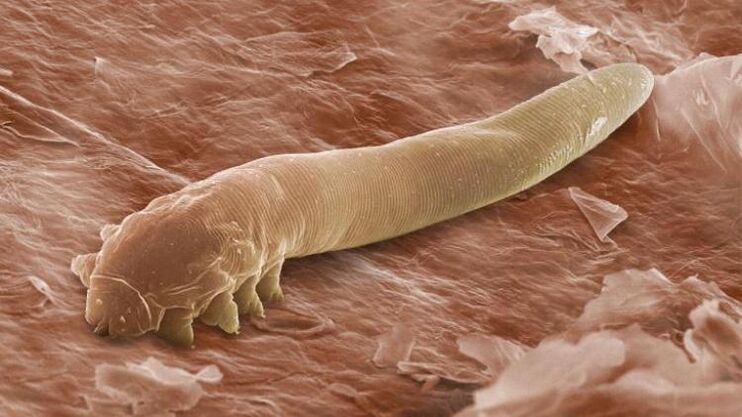 worm that lives under the human skin