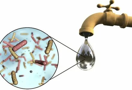 Parasites in a drop of water from the crane