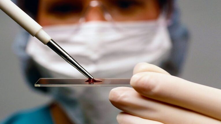 Blood test